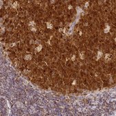 Anti-HMCES antibody produced in rabbit Prestige Antibodies&#174; Powered by Atlas Antibodies, affinity isolated antibody, buffered aqueous glycerol solution