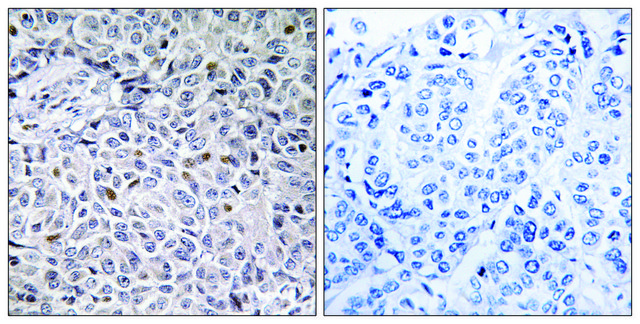 Anti-ZAP-70 antibody produced in rabbit affinity isolated antibody