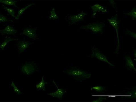 Monoclonal Anti-S100A7 antibody produced in mouse clone 1C5-C6, purified immunoglobulin, buffered aqueous solution