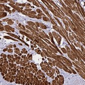 Anti-PGAM2 antibody produced in rabbit Prestige Antibodies&#174; Powered by Atlas Antibodies, affinity isolated antibody, buffered aqueous glycerol solution