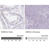 Anti-MORC4 antibody produced in rabbit Prestige Antibodies&#174; Powered by Atlas Antibodies, affinity isolated antibody, buffered aqueous glycerol solution