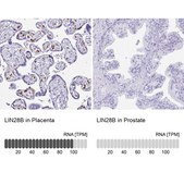 Anti-LIN28B antibody produced in rabbit Prestige Antibodies&#174; Powered by Atlas Antibodies, affinity isolated antibody, buffered aqueous glycerol solution