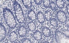 Anti-TGN46 Antibody, clone 2F13 ZooMAb&#174; Rabbit Monoclonal recombinant, expressed in HEK 293 cells