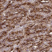 Anti-CHGA antibody produced in rabbit Prestige Antibodies&#174; Powered by Atlas Antibodies, affinity isolated antibody, buffered aqueous glycerol solution