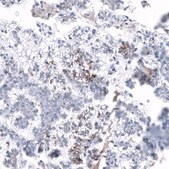 Anti-L1CAM antibody produced in mouse Prestige Antibodies&#174; Powered by Atlas Antibodies, clone CL12988, purified by using Protein A, buffered aqueous glycerol solution