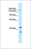 Anti-ABCC8 antibody produced in rabbit affinity isolated antibody