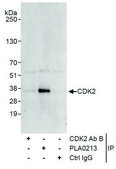 Rabbit anti-CDK2 Antibody, Affinity Purified Powered by Bethyl Laboratories, Inc.