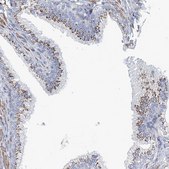 Anti-MAN1A2 antibody produced in rabbit Prestige Antibodies&#174; Powered by Atlas Antibodies, affinity isolated antibody, buffered aqueous glycerol solution