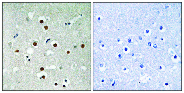 Anti-phospho-MEF2C (pSer396) antibody produced in rabbit affinity isolated antibody