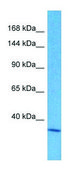 Anti-SRRM2 (C-terminal) antibody produced in rabbit affinity isolated antibody