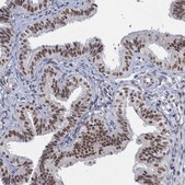 Anti-METTL14 antibody produced in rabbit Prestige Antibodies&#174; Powered by Atlas Antibodies, affinity isolated antibody, buffered aqueous glycerol solution
