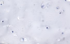 Anti-Lubricin/PRG4 Antibody, clone 9G3 ZooMAb&#174; Mouse Monoclonal recombinant, expressed in HEK 293 cells