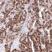 Anti-NCAM1 antibody produced in mouse Prestige Antibodies&#174; Powered by Atlas Antibodies, clone CL12732, purified by using Protein A, buffered aqueous glycerol solution