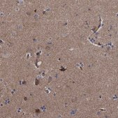 Anti-DTNBP1 antibody produced in rabbit Prestige Antibodies&#174; Powered by Atlas Antibodies, affinity isolated antibody, buffered aqueous glycerol solution