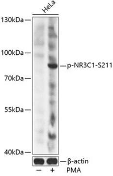 Anti-Phospho-NR3C1-S211 antibody produced in rabbit