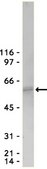 Anti-Akt/PKB Antibody, PH Domain, clone SKB1 clone SKB1, Upstate&#174;, from mouse