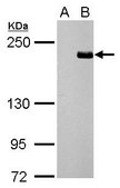 Anti-TET3 (C-terminal) antibody produced in rabbit affinity isolated antibody, buffered aqueous solution