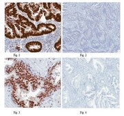 Anti-p53 (pantropic) Antibody, clone DO-1 clone DO-1, from mouse