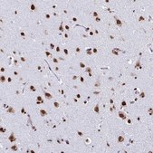 Anti-NONO antibody produced in rabbit Prestige Antibodies&#174; Powered by Atlas Antibodies, affinity isolated antibody, buffered aqueous glycerol solution