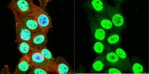 Anti-SNF2&#946;/BRG1 Antibody serum, Upstate&#174;