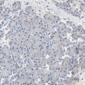 Anti-ALPL antibody produced in rabbit Ab2, Prestige Antibodies® Powered by Atlas Antibodies, affinity isolated antibody, buffered aqueous glycerol solution