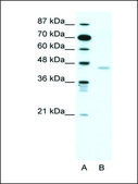 Anti-CNP antibody produced in rabbit IgG fraction of antiserum