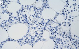 Anti-Bcl-xL Antibody, clone 1O8 ZooMAb&#174; Rabbit Monoclonal recombinant, expressed in HEK 293 cells