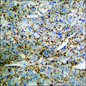 Anti-phospho-Chk1 (pSer345) antibody produced in rabbit affinity isolated antibody