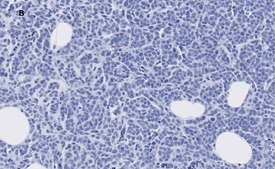 Anti-phospho-IRS1 (Tyr612) Antibody, clone 1N14, ZooMAb&#174; Rabbit Monoclonal recombinant, expressed in HEK 293 cells