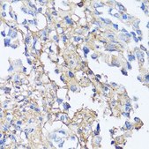Anti-Fibronectin antibody produced in rabbit