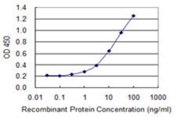 Monoclonal Anti-ZNF598 antibody produced in mouse clone 1E2, purified immunoglobulin, buffered aqueous solution