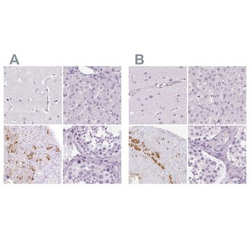 Anti-POMC antibody produced in rabbit Prestige Antibodies&#174; Powered by Atlas Antibodies, affinity isolated antibody