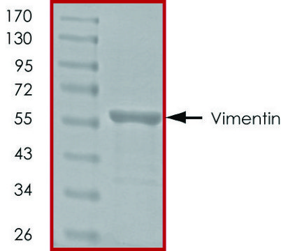 Vimentin, His tagged human recombinant, expressed in E. coli, &#8805;90% (SDS-PAGE), buffered aqueous glycerol solution