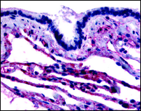 Anti-CAV1 (AB2) antibody produced in rabbit affinity isolated antibody, buffered aqueous solution