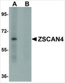 Anti-ZSCAN4 antibody produced in rabbit affinity isolated antibody, buffered aqueous solution