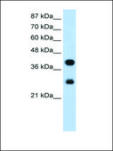Anti-PCBP2 (AB1) antibody produced in rabbit IgG fraction of antiserum