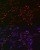 Anti-ACAA2 Antibody, clone 8H6H5, Rabbit Monoclonal