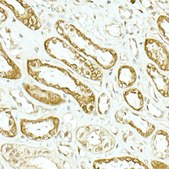 Anti-IDH1 Antibody, clone 5S2U7, Rabbit Monoclonal
