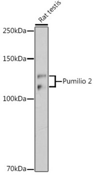 Anti-Pumilio 2 Antibody, clone 7M1B1, Rabbit Monoclonal