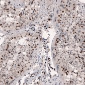 Monoclonal Anti-METTL14 antibody produced in mouse Prestige Antibodies&#174; Powered by Atlas Antibodies, clone CL4254, purified immunoglobulin