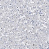 Anti-RSPH4A antibody produced in rabbit Prestige Antibodies&#174; Powered by Atlas Antibodies, affinity isolated antibody, buffered aqueous glycerol solution