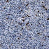 Anti-GZMM antibody produced in rabbit Prestige Antibodies&#174; Powered by Atlas Antibodies, affinity isolated antibody, buffered aqueous glycerol solution
