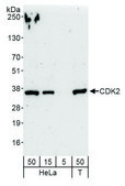 Rabbit anti-CDK2 Antibody, Affinity Purified Powered by Bethyl Laboratories, Inc.