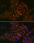 Anti-KRAS+HRAS+NRAS Antibody, clone 6S6F3, Rabbit Monoclonal