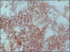 Anti-Histone Deacetylase 1 (HDAC1) antibody produced in rabbit IgG fraction of antiserum, buffered aqueous solution