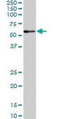 ANTI-RARA antibody produced in mouse clone 1C10, purified immunoglobulin, buffered aqueous solution