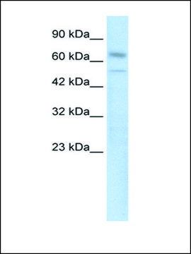 Anti-ZNF306 antibody produced in rabbit affinity isolated antibody