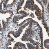 Anti-RUVBL1 antibody produced in rabbit Prestige Antibodies&#174; Powered by Atlas Antibodies, affinity isolated antibody, buffered aqueous glycerol solution, Ab2