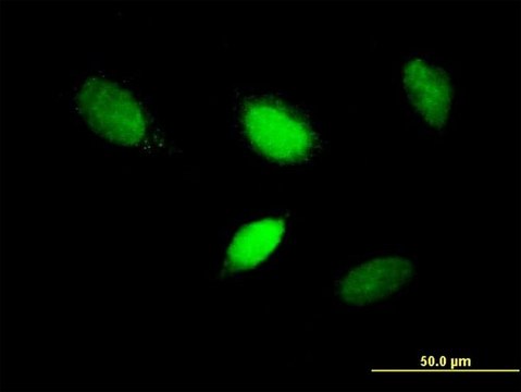 Anti-T antibody produced in mouse purified immunoglobulin, buffered aqueous solution