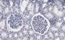 Anti-SLC12A3 Antibody, clone 3I12 ZooMAb&#174; Rabbit Monoclonal recombinant, expressed in HEK 293 cells